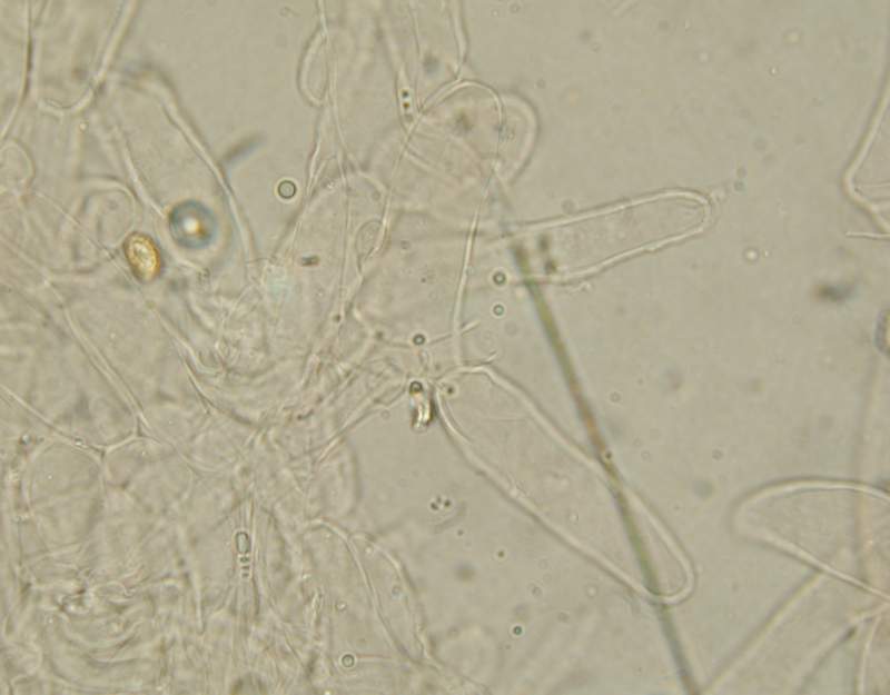 Fungo e il suo micelio.......